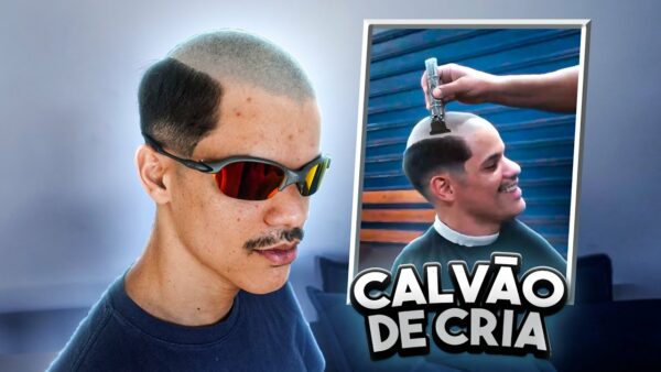 Calvície na moda! Corte de cabelo calvão de cria viraliza nas